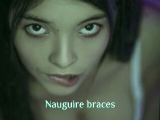 Nauguire_braces